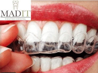 Tratamiento de ortodoncia Madit